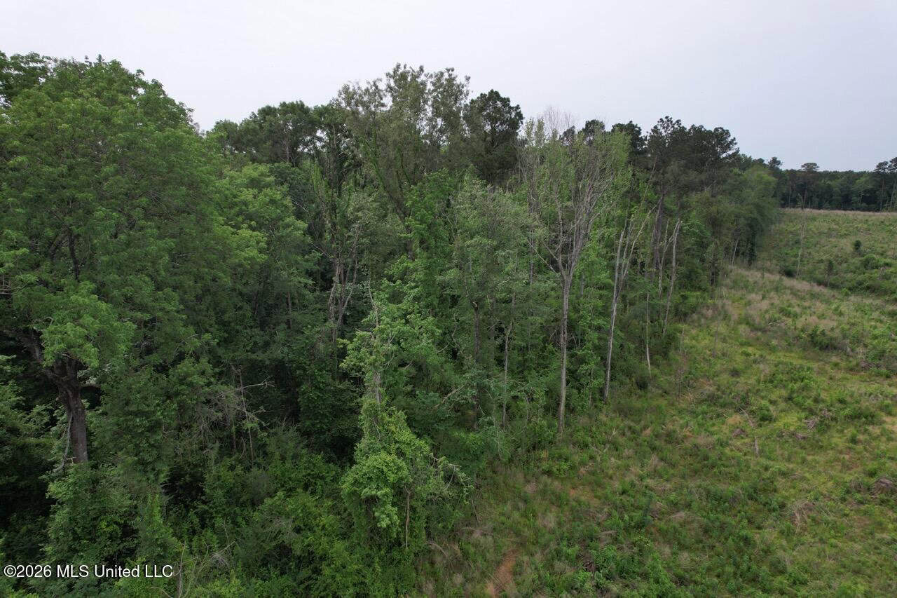 15 Acres with Pond & Homesite in Liberty, MS